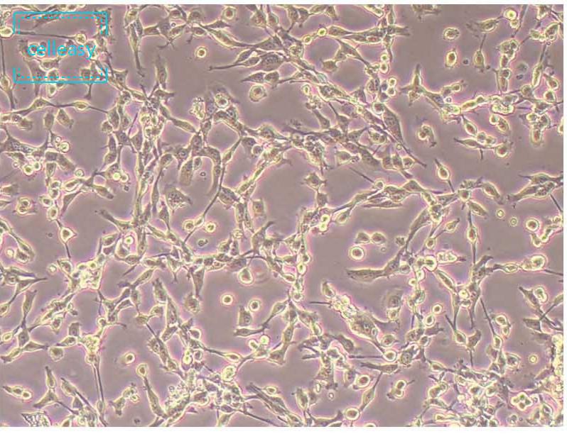 小鼠结肠癌细胞