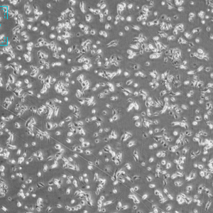 小鼠黑色素瘤细胞