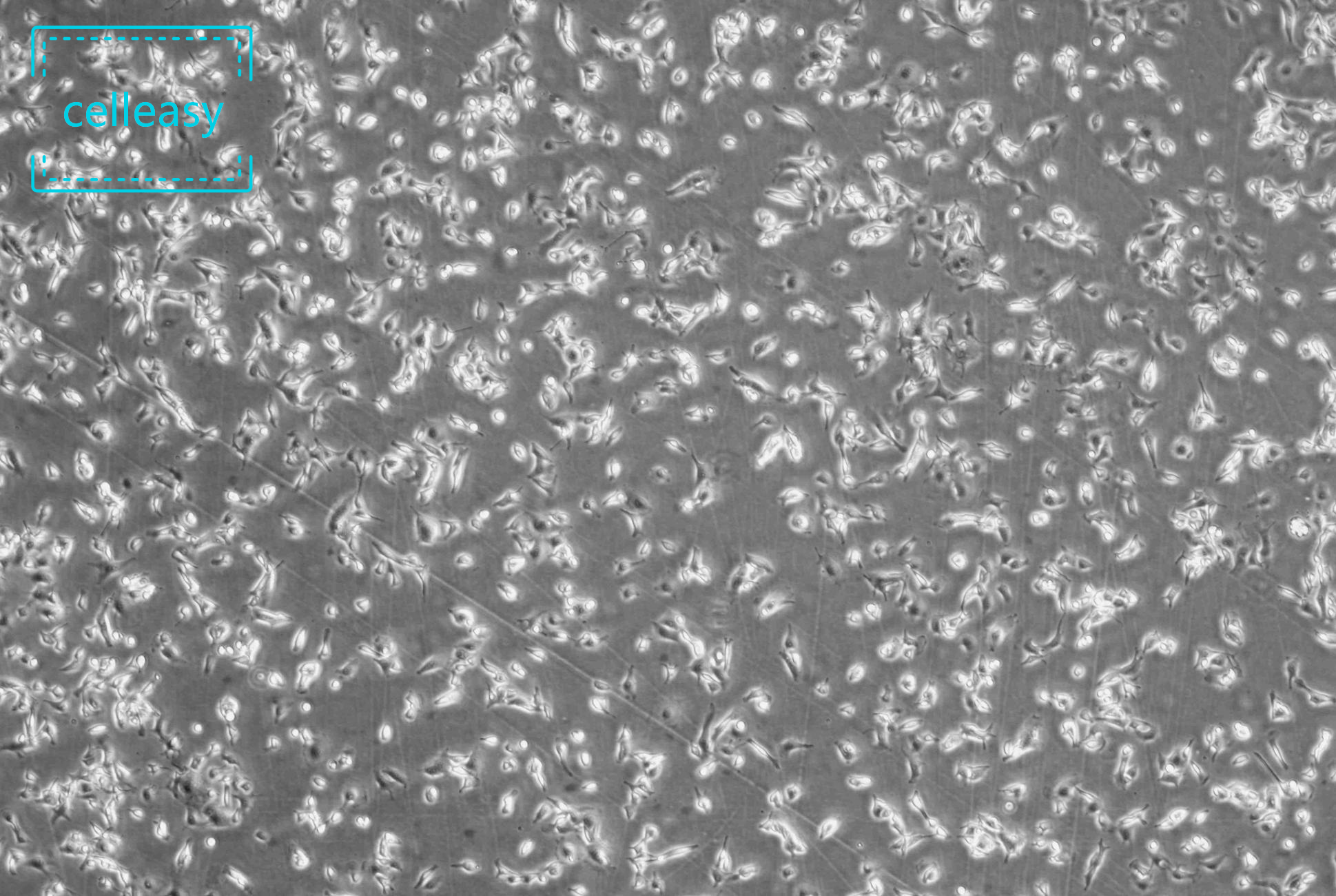 小鼠黑色素瘤细胞